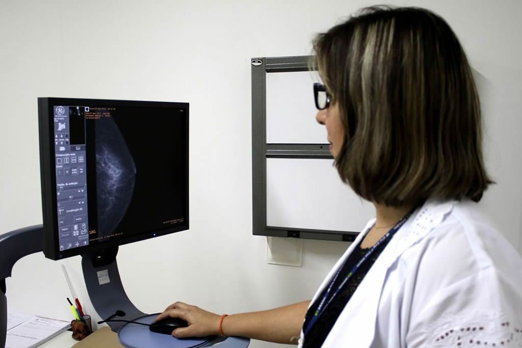 mamografia_rodrigo_nunes_ministerio_da_saude