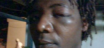 Quilombola é agredido por agentes penitenciários no norte do Estado