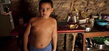 Documentário alerta para a obesidade infantil